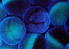 دانشمندان سرعت مرگ را اندازه گرفتند